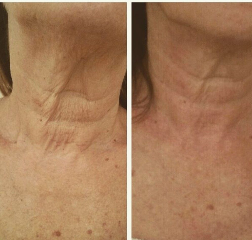 Facial lymphatic drainage treatment at Unique Boutique in Newton Centre, MA