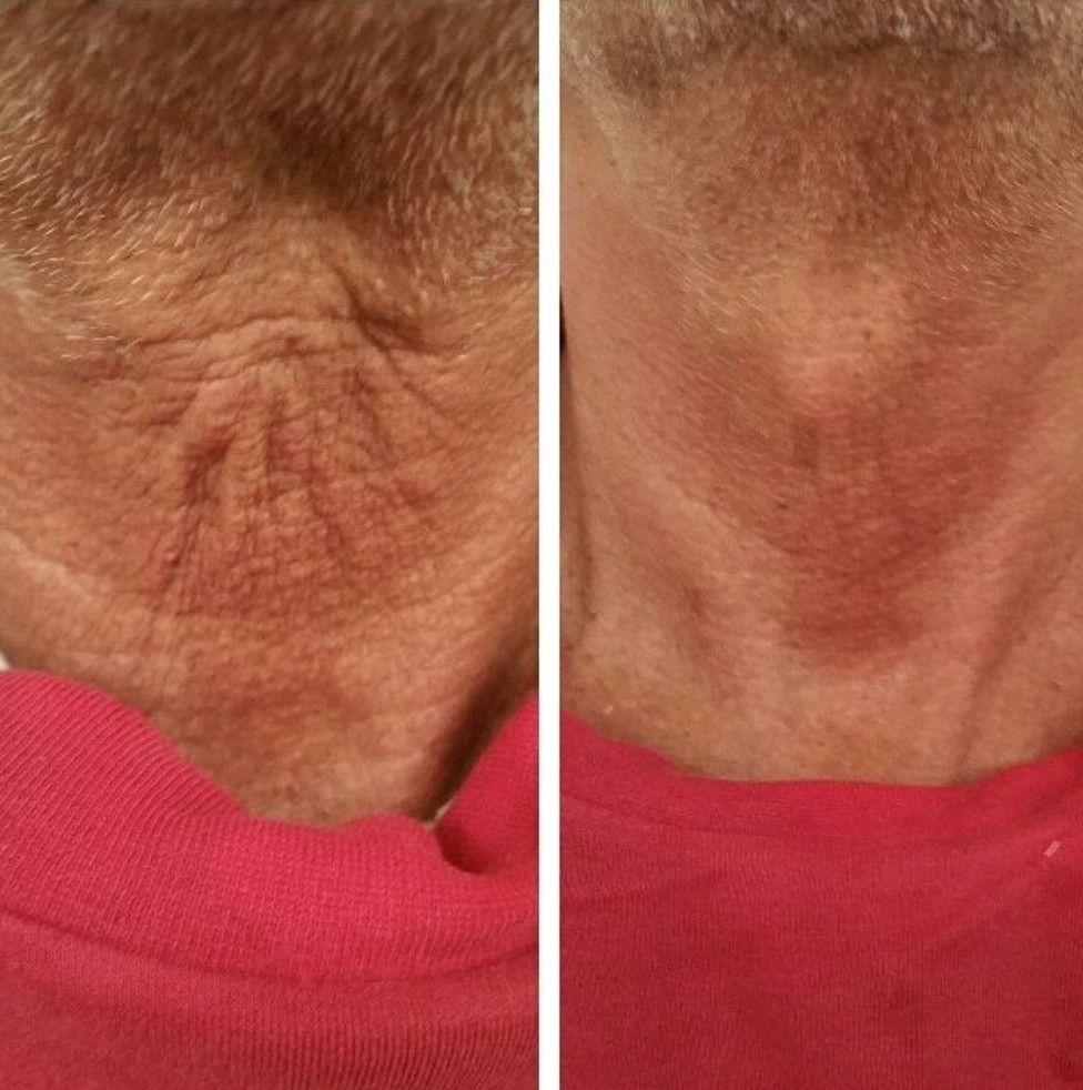 Skin pigmentation correction treatment at Unique Boutique in Newton Centre, MA