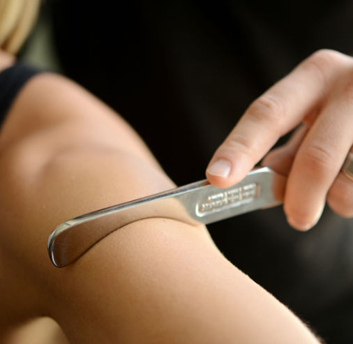 Microneedling collagen induction treatment at Unique Boutique in Newton Centre, MA