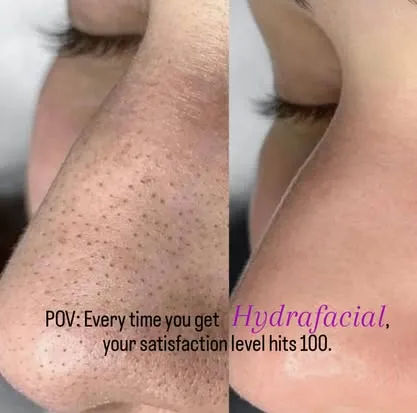 Unique Boutique in Newton Centre — HydraFacial MD glow-up