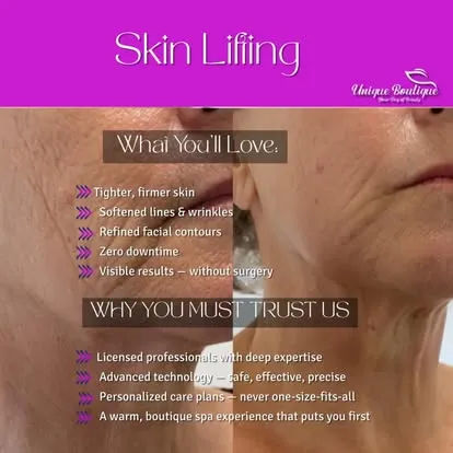 Unique Boutique in Newton Centre — Skin Tightening jawline refine