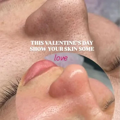Unique Boutique in Newton Centre — Laser Hair Removal result